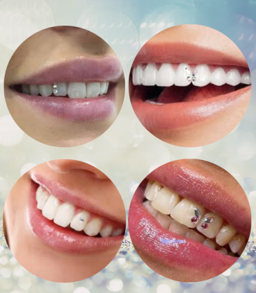 Kit Profesional Joyas Dentales Tooth Fairy para Salones de Estética