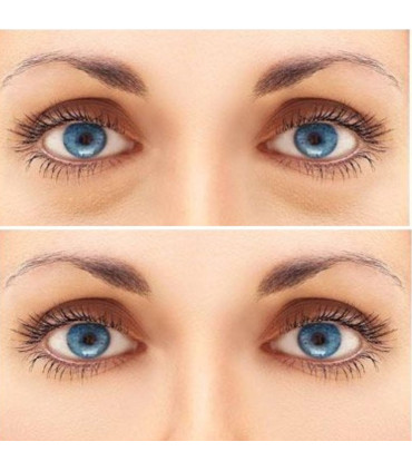 Flash Flawless Antiojeras Efecto Inmediato ⚡ Pro