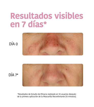 Mascarilla Hidratante Aloe Vera y Hialurónico 💦 Iroha