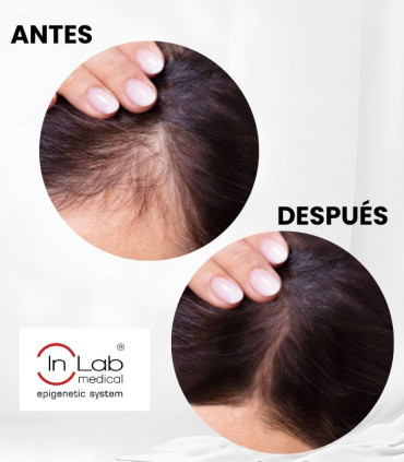 InLab Exohair Plus: Viales Anticaída Exosomas 💆‍♀️✨