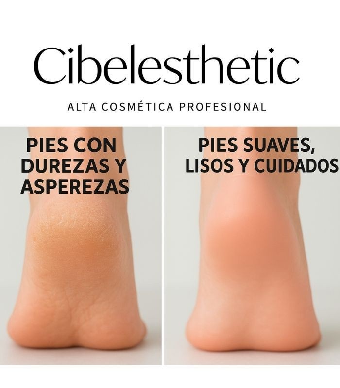 Reblandecedor de Durezas 🦶 Cibelesthetic Cibelfoot 500ml Profesional