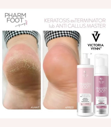 Gel Eliminador Callos Keratosis 300ml 🦶 Pharm Foot Pro
